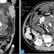 A CT scan of the fetus in fetu found inside the woman’s abdomen